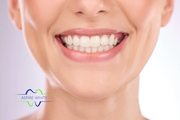 Follow your teeth whitening aftercare Blackpool to prolong your whiter smile!